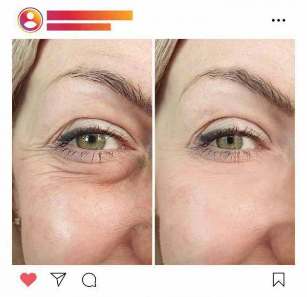 Augenringe-Creme